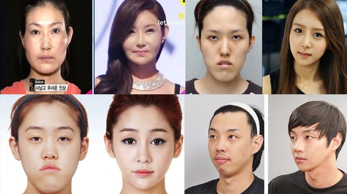 hasil operasi korea selatan